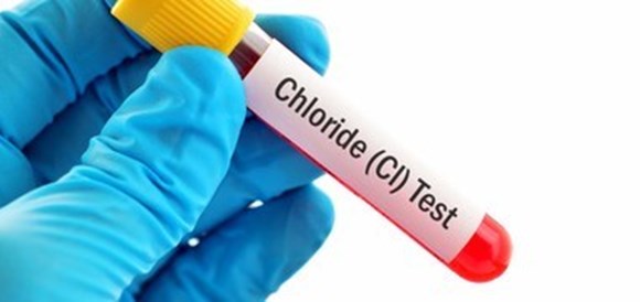 רמת כלור בדם (Chloride) - תמונה